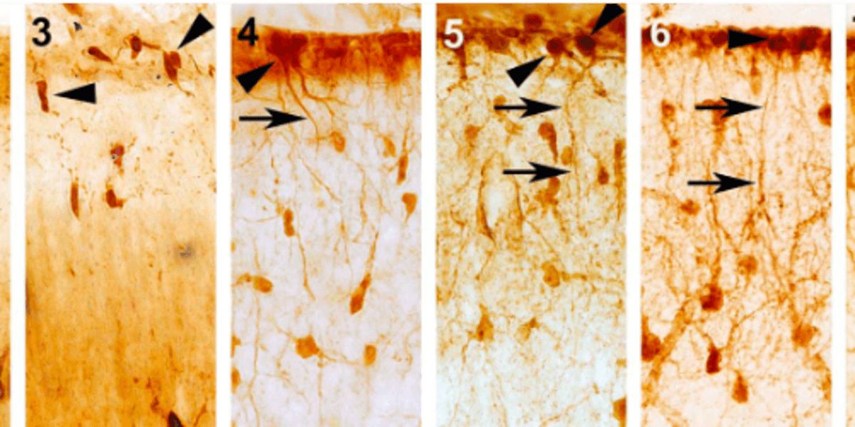 ILA early development in rhesus macaque (Falcone et al. 2020)