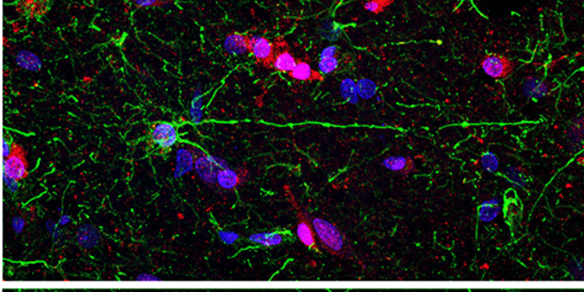 Varicose-projection astrocyte in humans (Falcone et al. 2021)