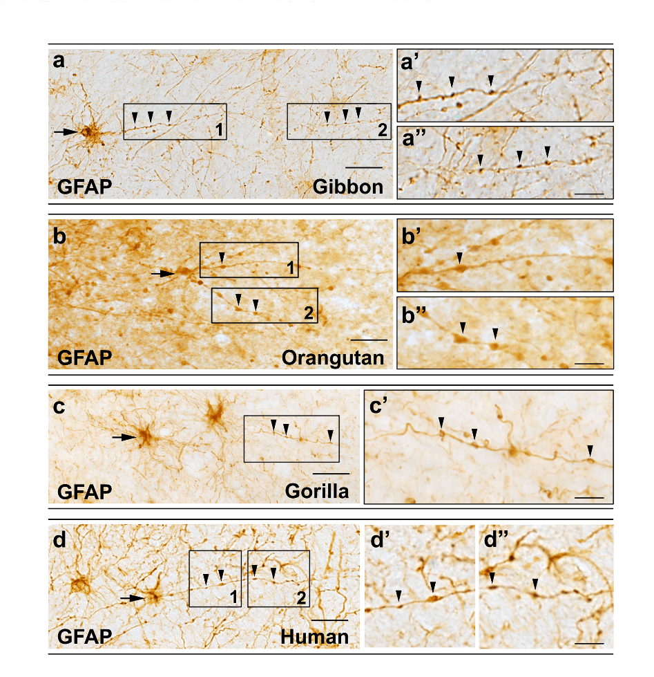 Astrocyte Evolution and Development