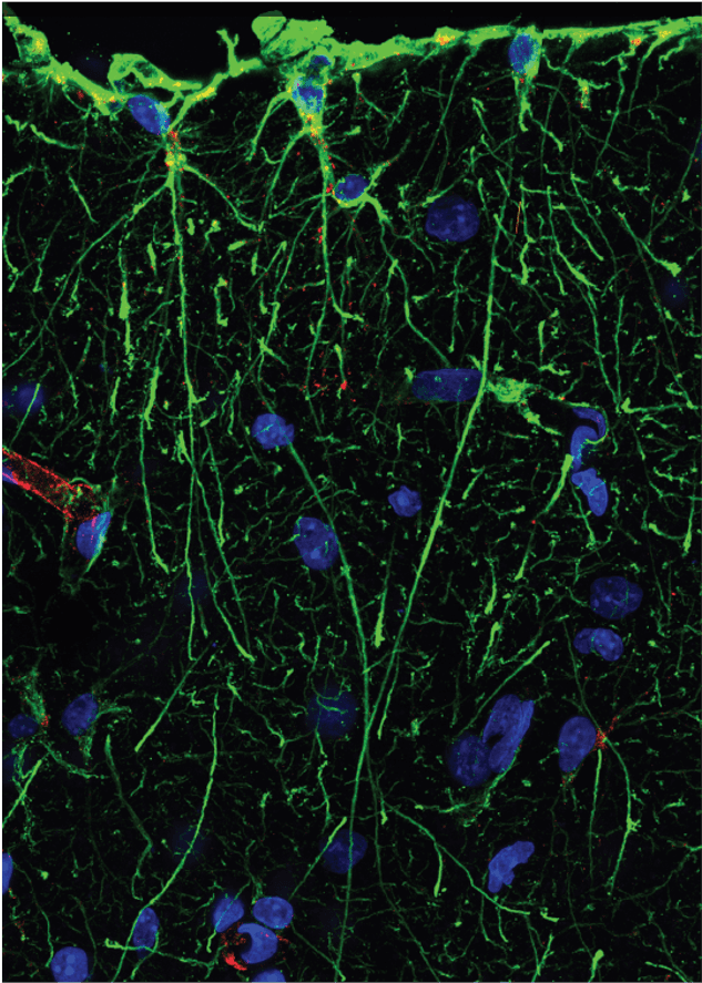Unraveling the functions of Interlaminar Astrocytes in the primate brain